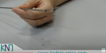 Pinça Bidente - Video Demonstrativo Geral