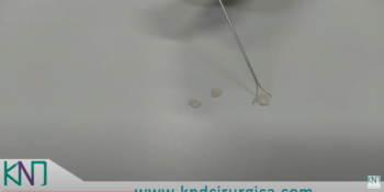 Pinça Tridente - Video Demonstrativo Geral